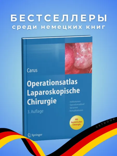 Operationsatlas Laparoskopische Chirurgie 2014