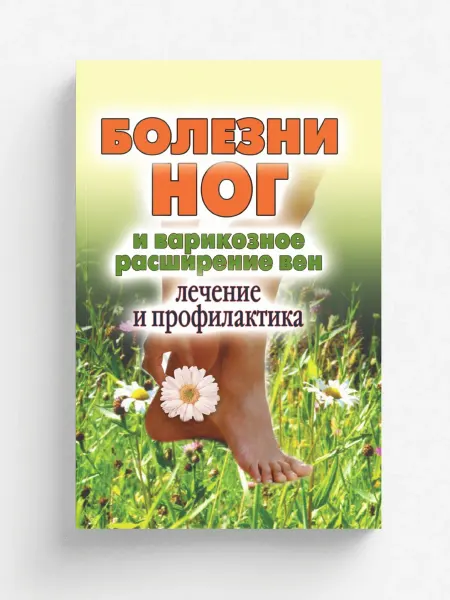 Рипол Болезни ног и варикозное расширение вен. Лечение и п
