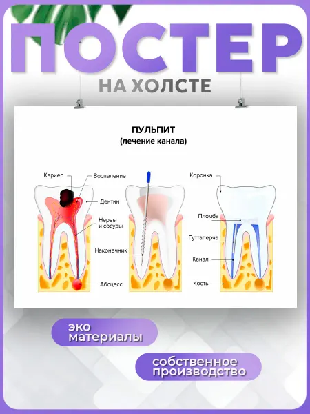 POSTERNAK Постер Стоматология медицина анатомия зуба (9) 30х40 см