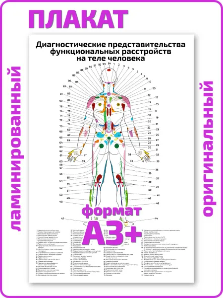 Квинг Диагностические представительства расстройств плакат А3