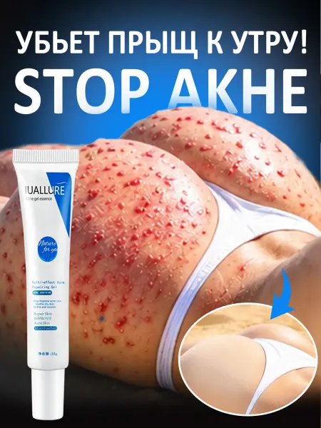 IUALLURE Сыворотка-гель для лица и тела от прыщей и акне