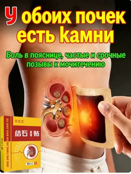 Пластырь от камней в почках 6 шт