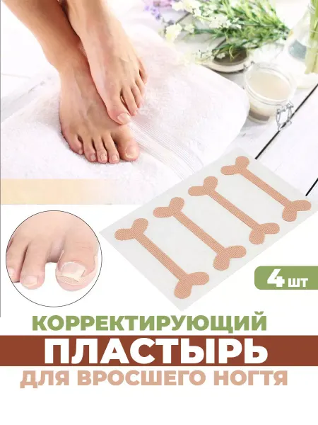 Luxottire От вросшего ногтя пластырь корректор, от врастания на пальце