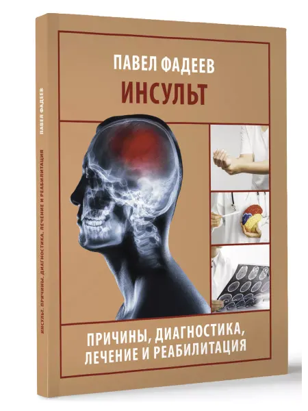 Издательство АСТ Инсульт. Причины, диагностика, лечение и реабилитация