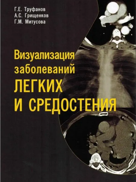 Элби-СПБ Визуализация заболеваний легких и средостения