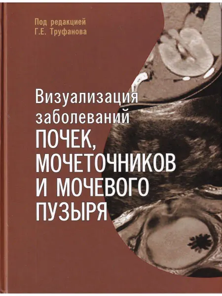 Элби-СПБ Визуализация заболеваний почек,мочеточников и мочевого пузыр