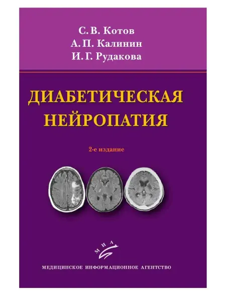 Медицинское информационное агентство Диабетическая нейропатия