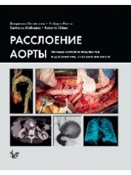 Логосфера(Изд) Расслоение аорты личные истории пациентов и достижения