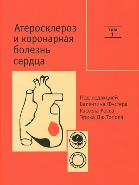 Медицина Атеросклероз и коронарная болезнь сердца