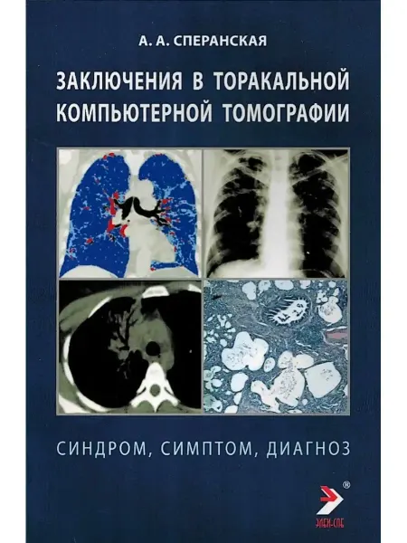 Элби-СПБ Заключение в торакальной компьютерной томографии
