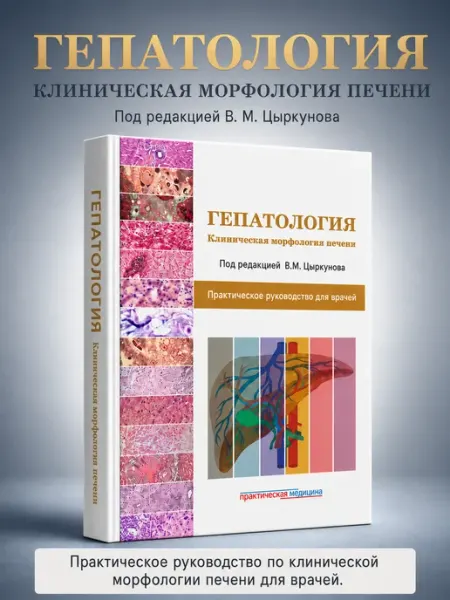 Booksmed Гепатология Клиническая морфология печени