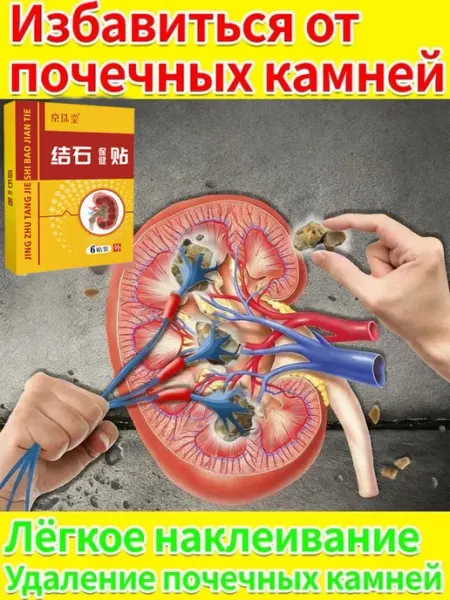 Пластырь для растворения почечных камней